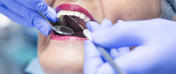 Best Emergency Root Canal Therapy in Monticello, MN